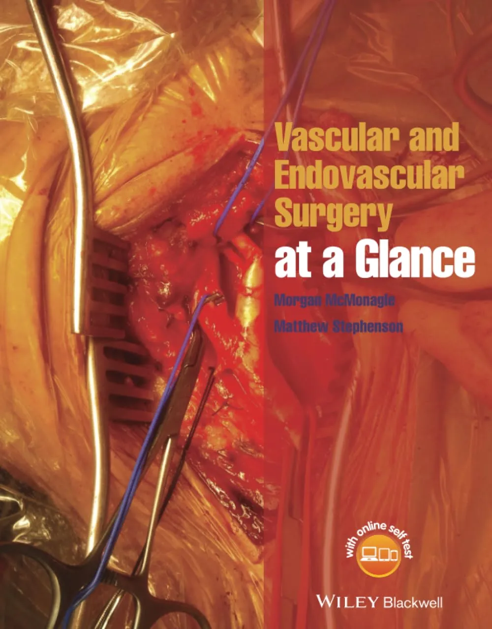 Vascular and Endovascular Surgery at a Glance | Paperback