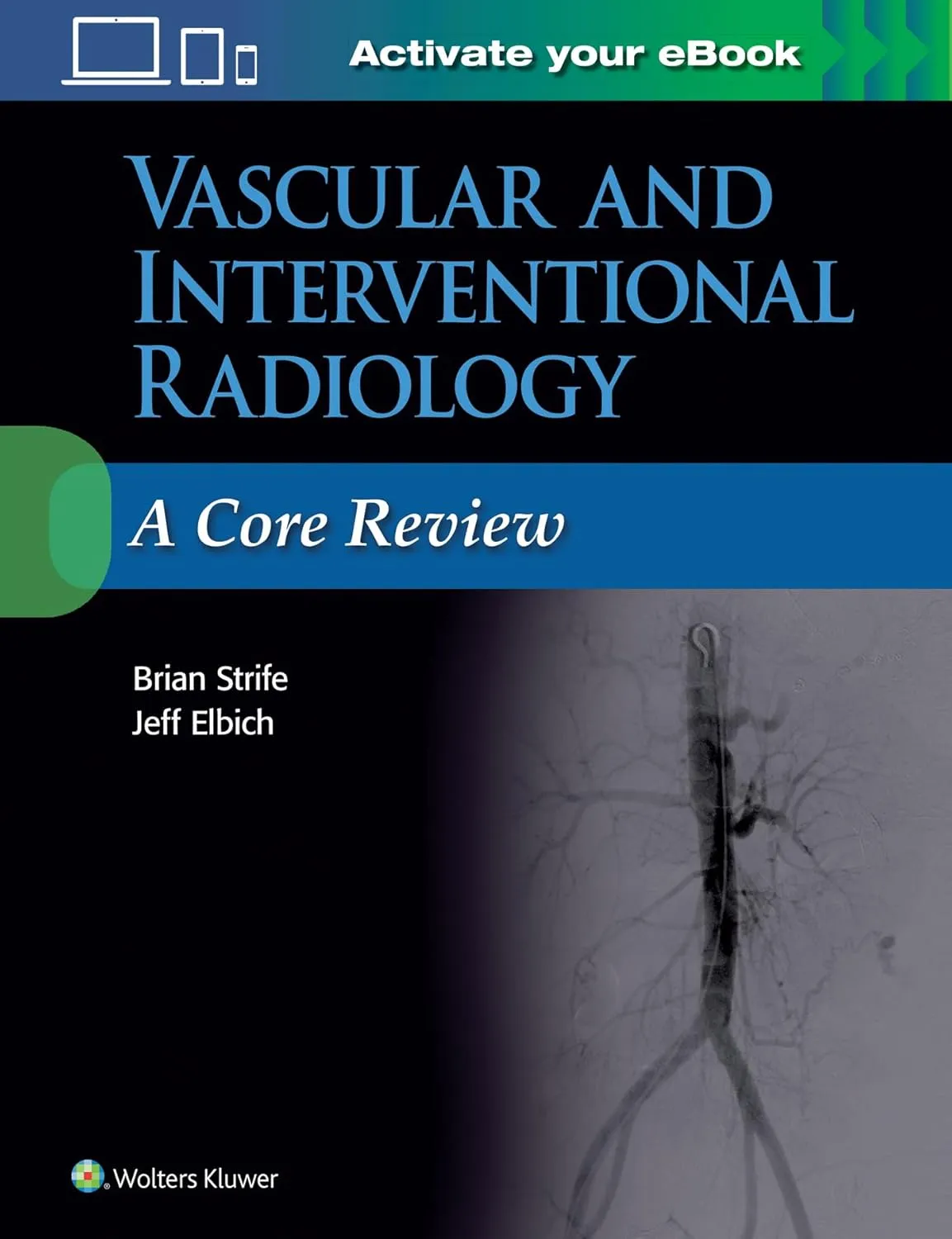 Vascular and Interventional Radiology A Core Review | Paperback