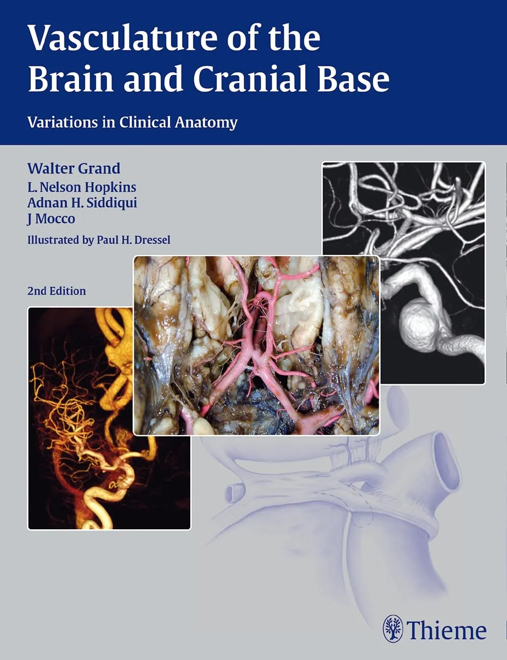 Vasculature of the Brain and Cranial Base | 2nd Edition | Hardcover