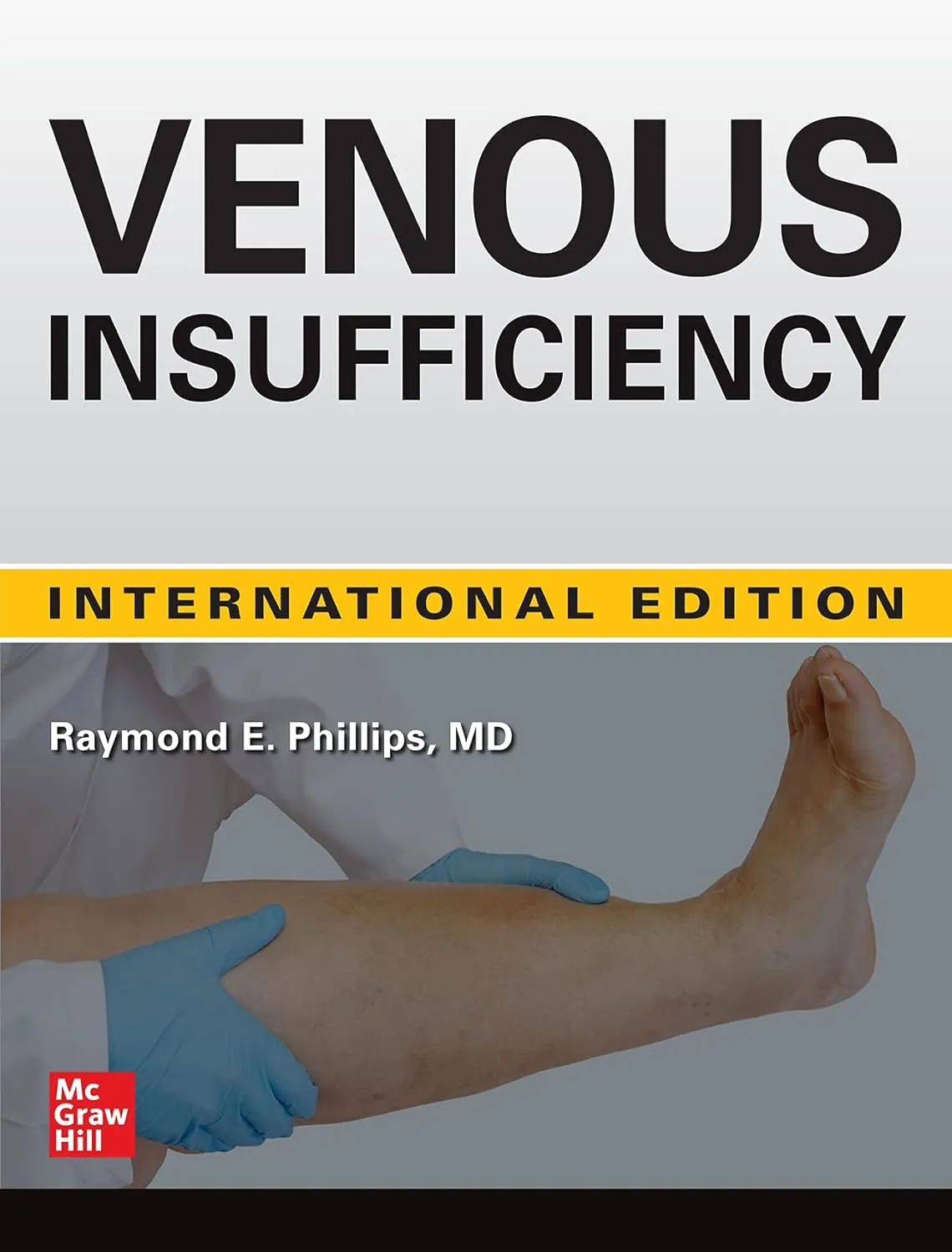 Venous Insufficiency (Ie) | Hardcover