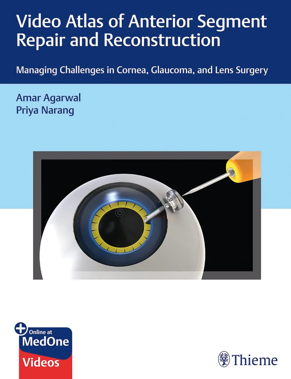 Video Atlas of Anterior Segment Repair and Reconstruction | Paperback