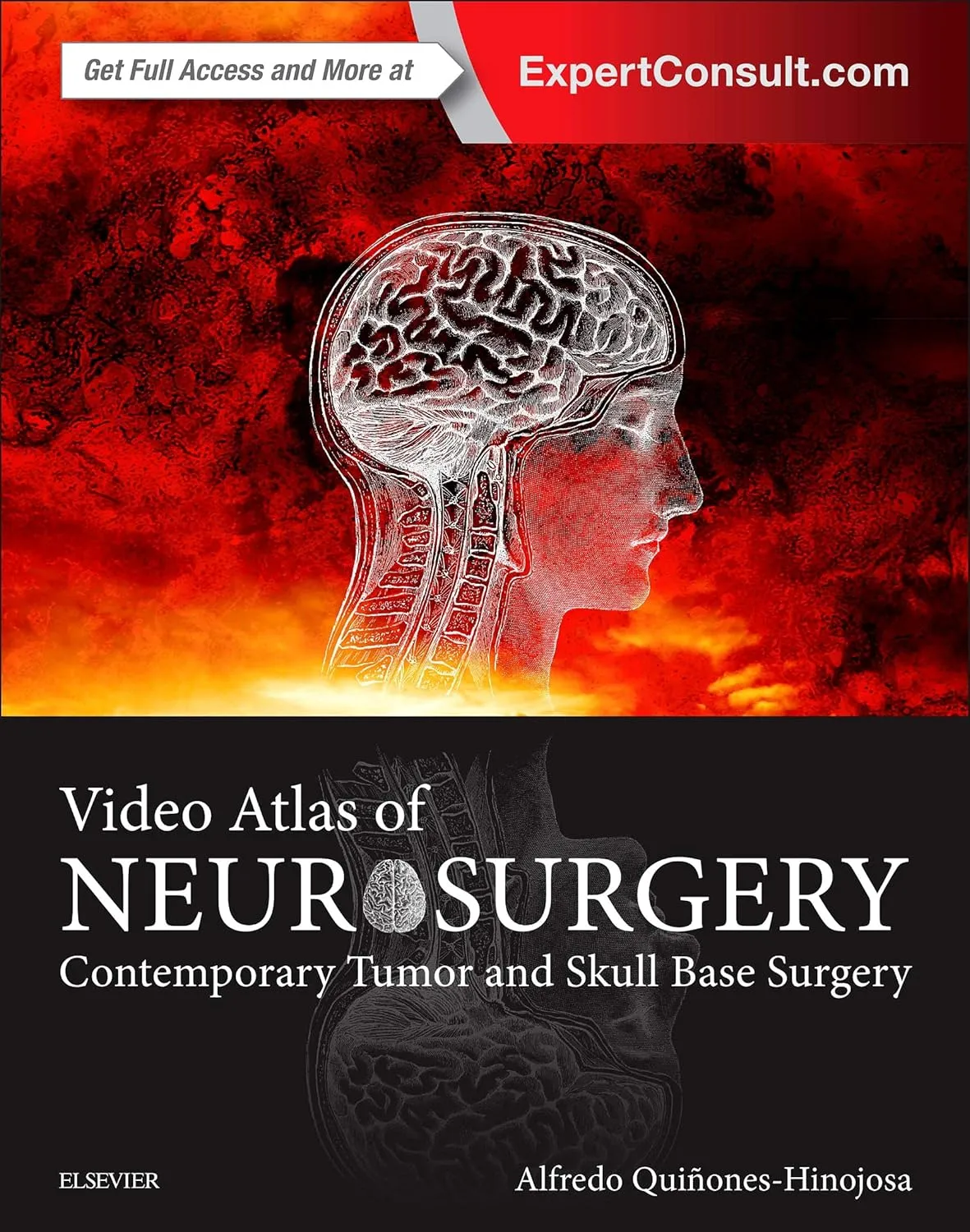 Video Atlas of Neurosurgery Contemporary Tumor and Skull Base Surgery | Hardcover