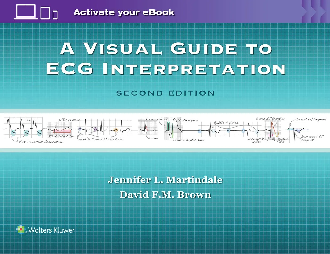 A Visual Guide to ECG Interpretation | 2nd Edition | Paperback