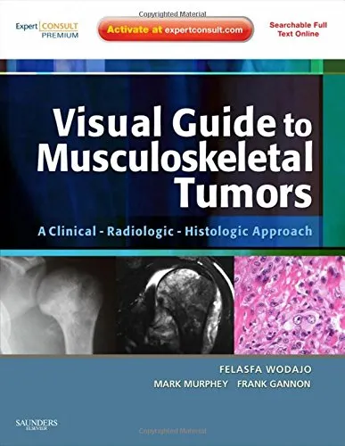 Visual Guide to Musculoskeletal Tumors A Clinical-Radiologic-Histologic Approach | Hardcover