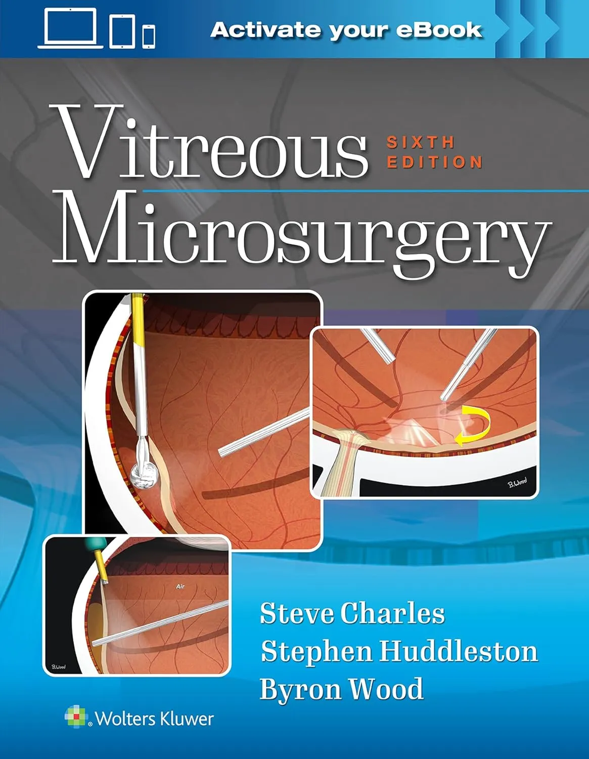 Vitreous Microsurgery 6th Edition | Hardcover