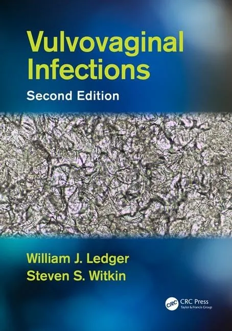 Vulvovaginal Infections | 2nd Edition | Paperback