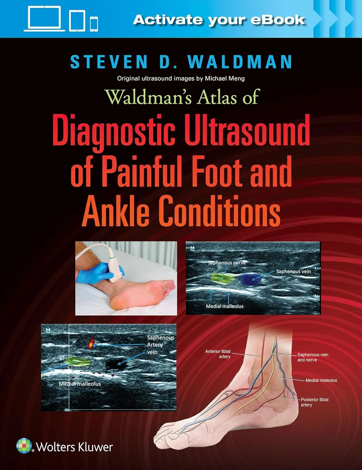 Waldman's Atlas of Diagnostic Ultrasound of Painful Foot and Ankle Conditions | Hardcover