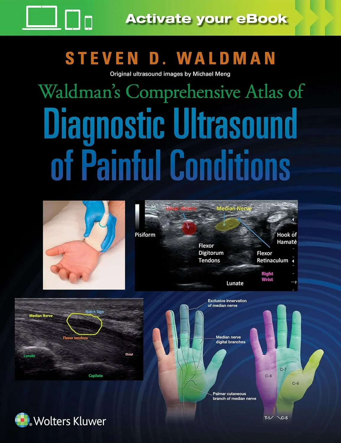 Waldman's Comprehensive Atlas of Diagnostic Ultrasound of Painful Conditions | Hardcover
