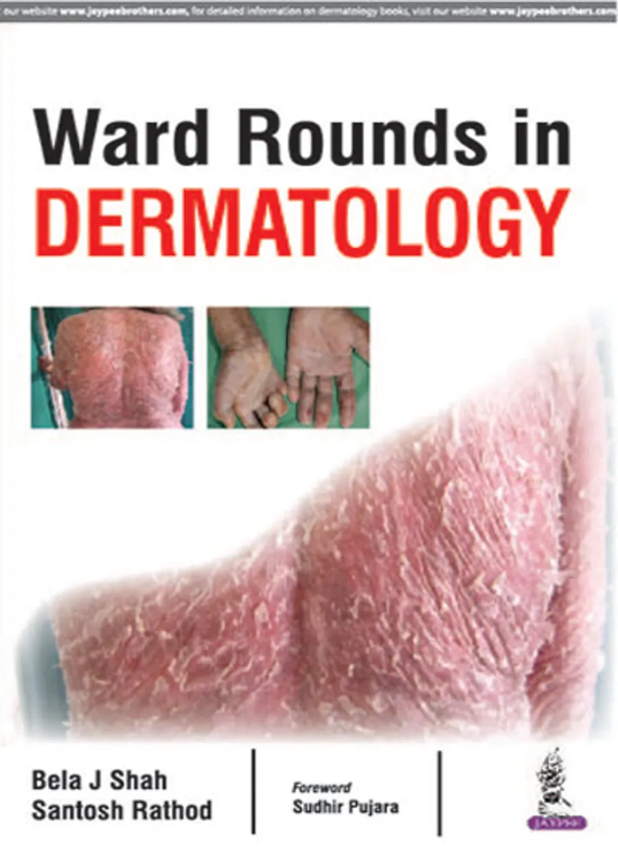 Ward Rounds In Dermatology | Paperback