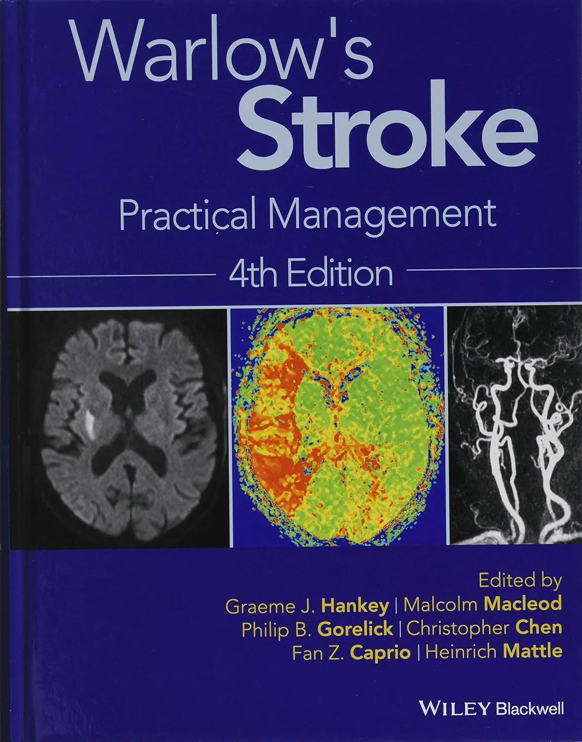 Warlow's Stroke Practical Management | 4th Edition | Hardcover