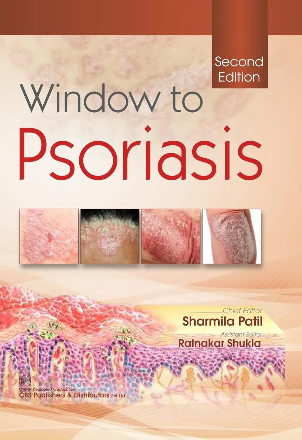 Window To Psoriasis 2nd Edition | Hardcover