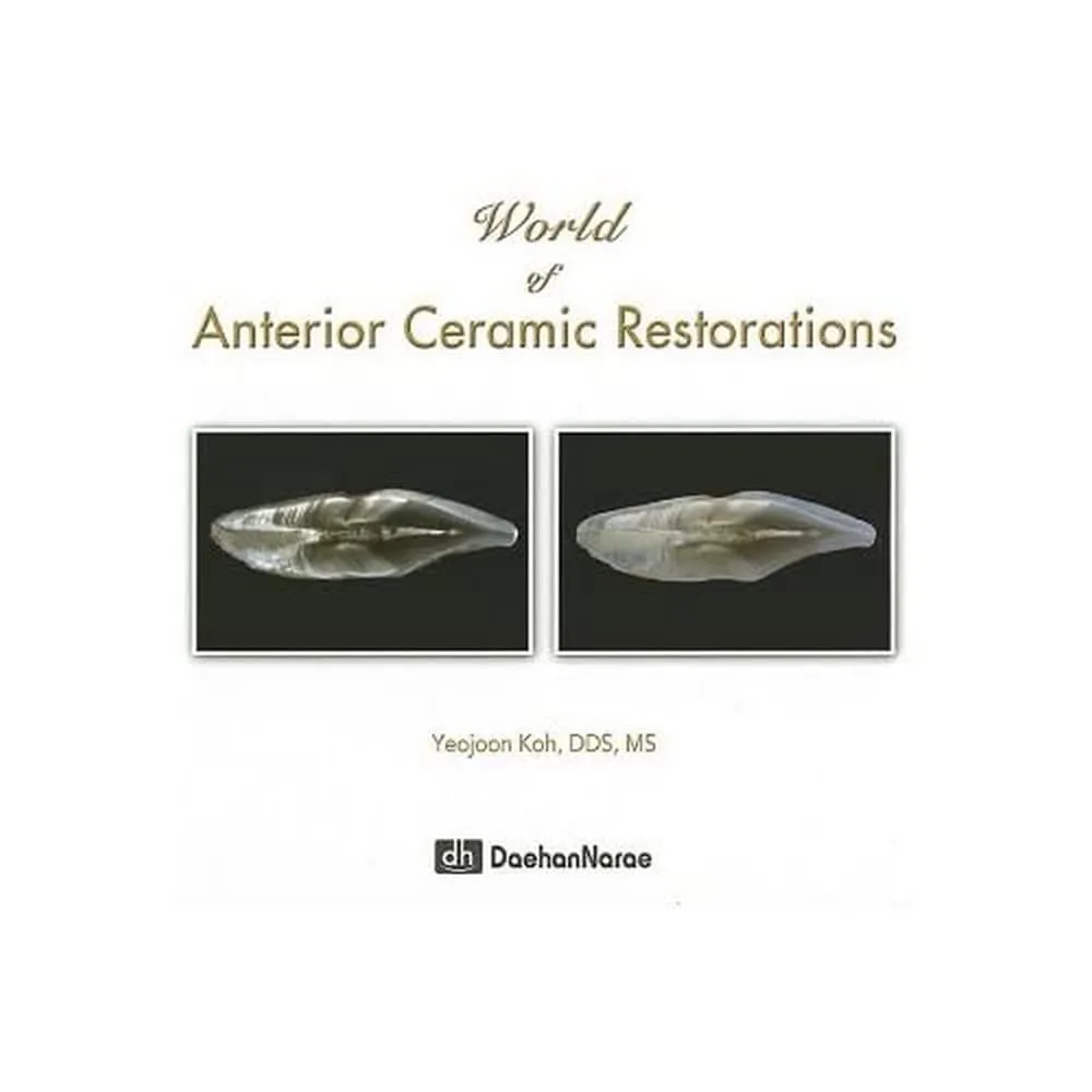 World of Anterior Ceramic Restorations | Hardcover