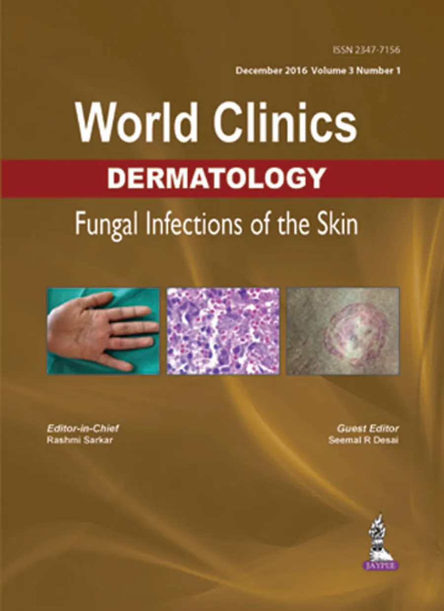 World Clinics Dermatology Fungal Infections Of The Skin (Dec.2016,Vol.3,No.1) | Hardcover