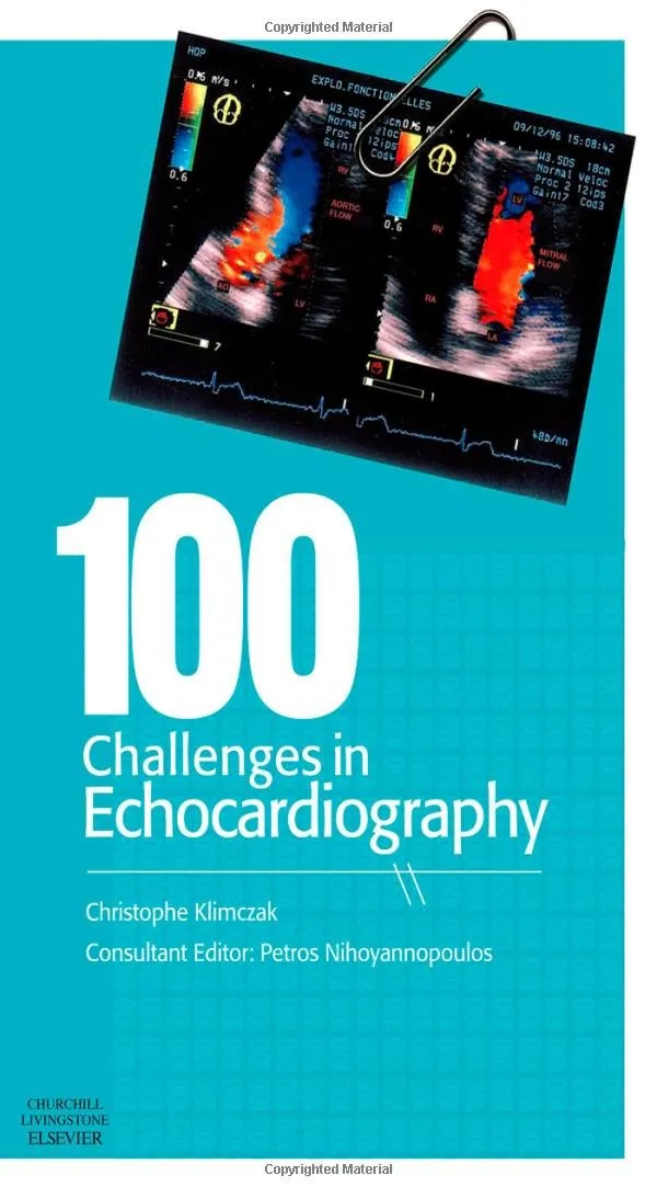 100 Challenges in Echocardiography - 1st Edition