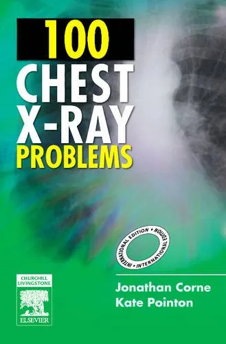 100 Chest X-Ray Problems - 1st Edition