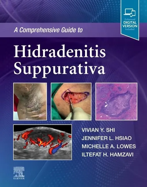 A Comprehensive Guide to Hidradenitis Suppurativa-1E