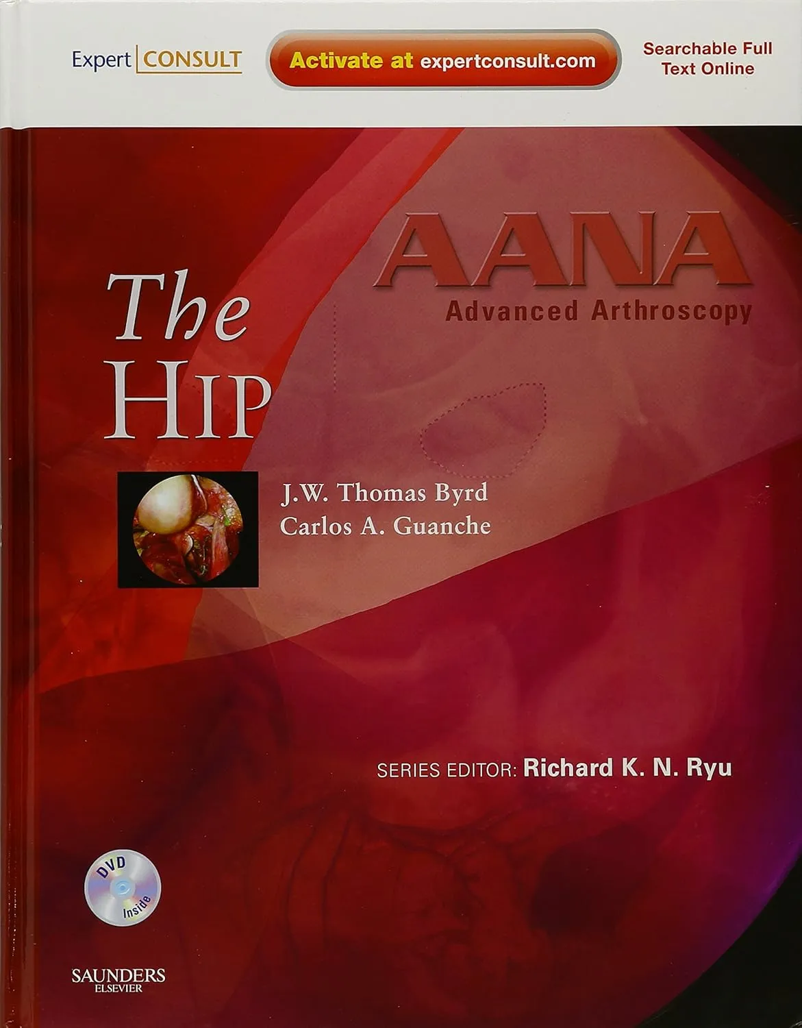 Advanced Arthoscopy: The Hip - 1E