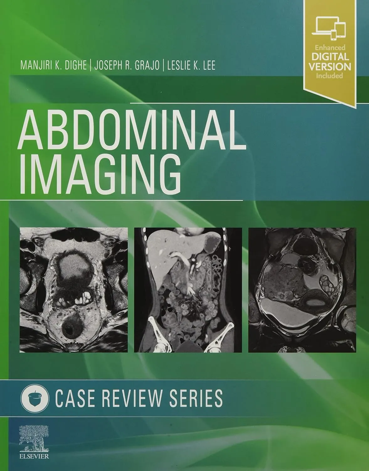Abdominal Imaging-1ED