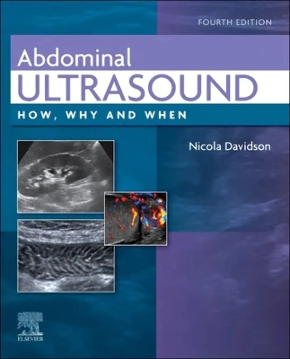 Abdominal Ultrasound-4E
