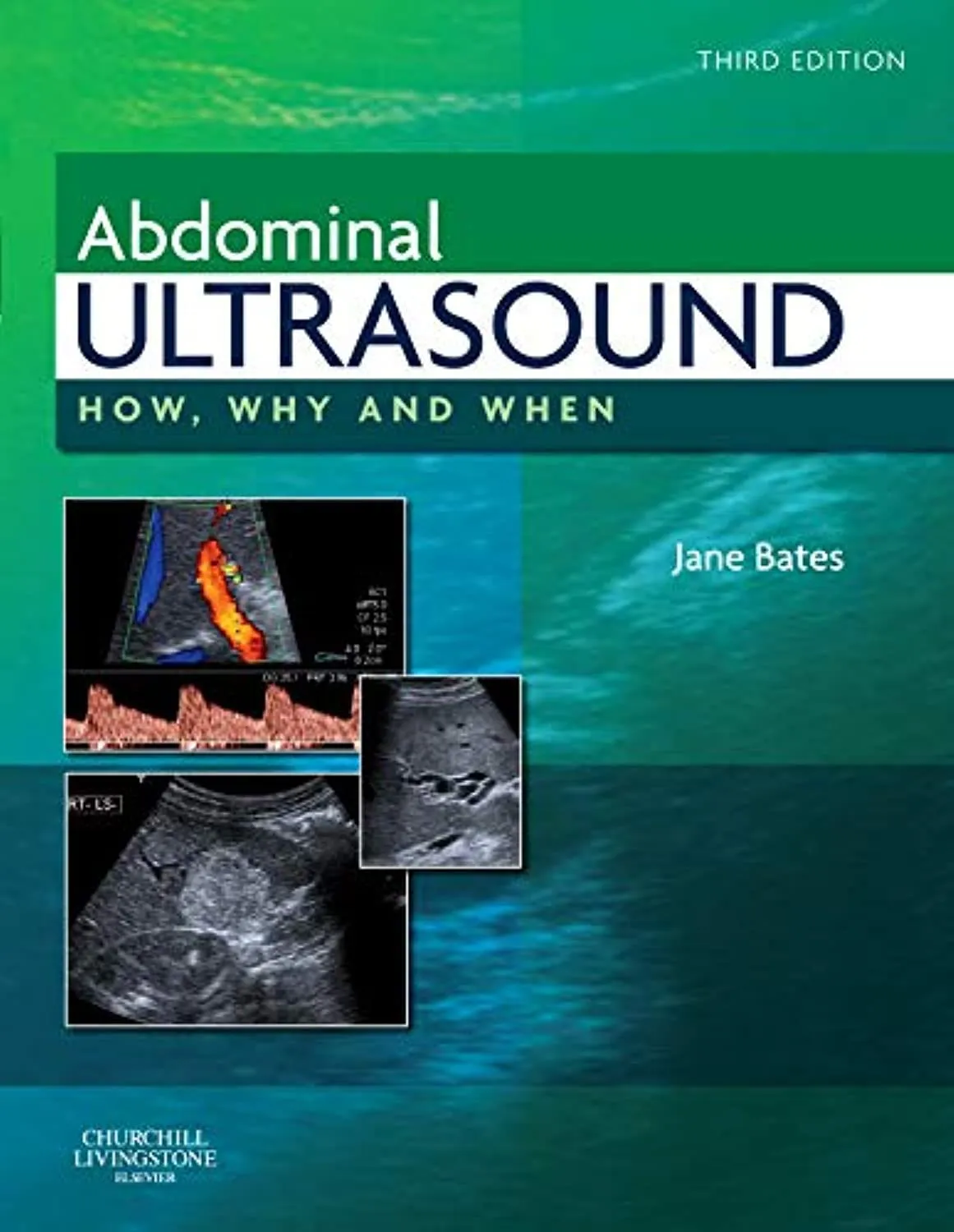 Abdominal Ultrasound How, Why and When - Third Edition