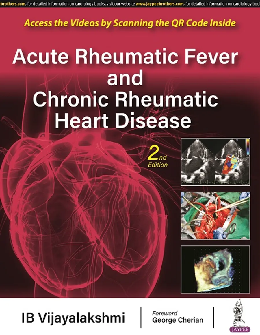 Image of Acute Rheumatic Fever and Chronic Rheumatic Heart Disease