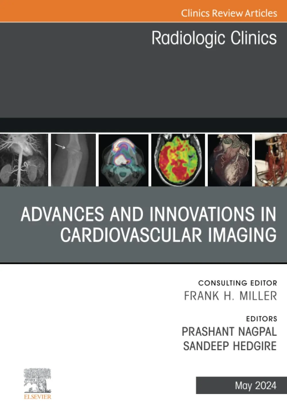 Advances and Innovations in Cardiovascular Imaging, An Issue of Radiologic Clinics of North America-1