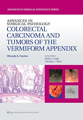 Advances in Surgical Pathology: Colorectal Carcinoma and Tumors of the Vermiform Appendix - 1st Edition