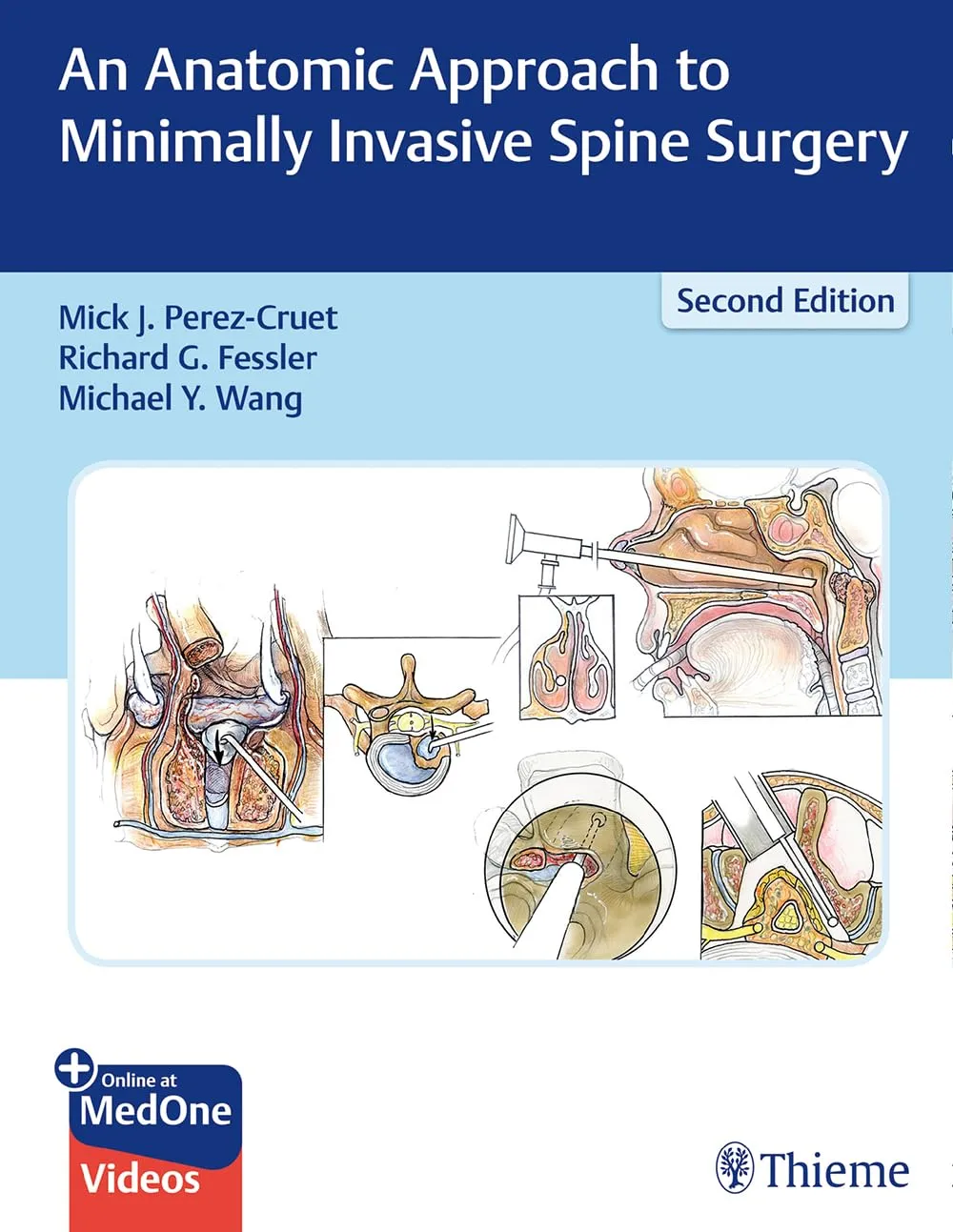 An Anatomic Approach to Minimally Invasive Spine Surgery 2nd Ed.