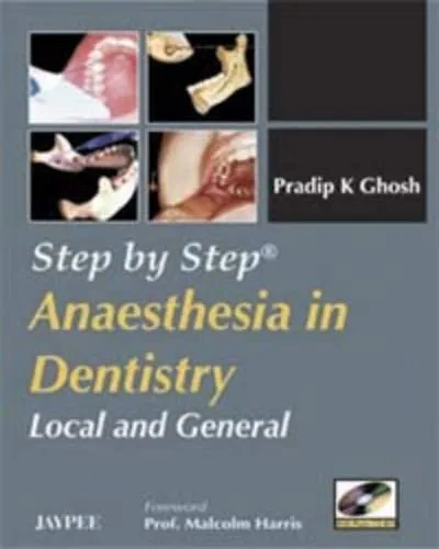 Step by Step Anaesthesia in Dentistry Local and General with Photo Cd-rom - 1st Edition