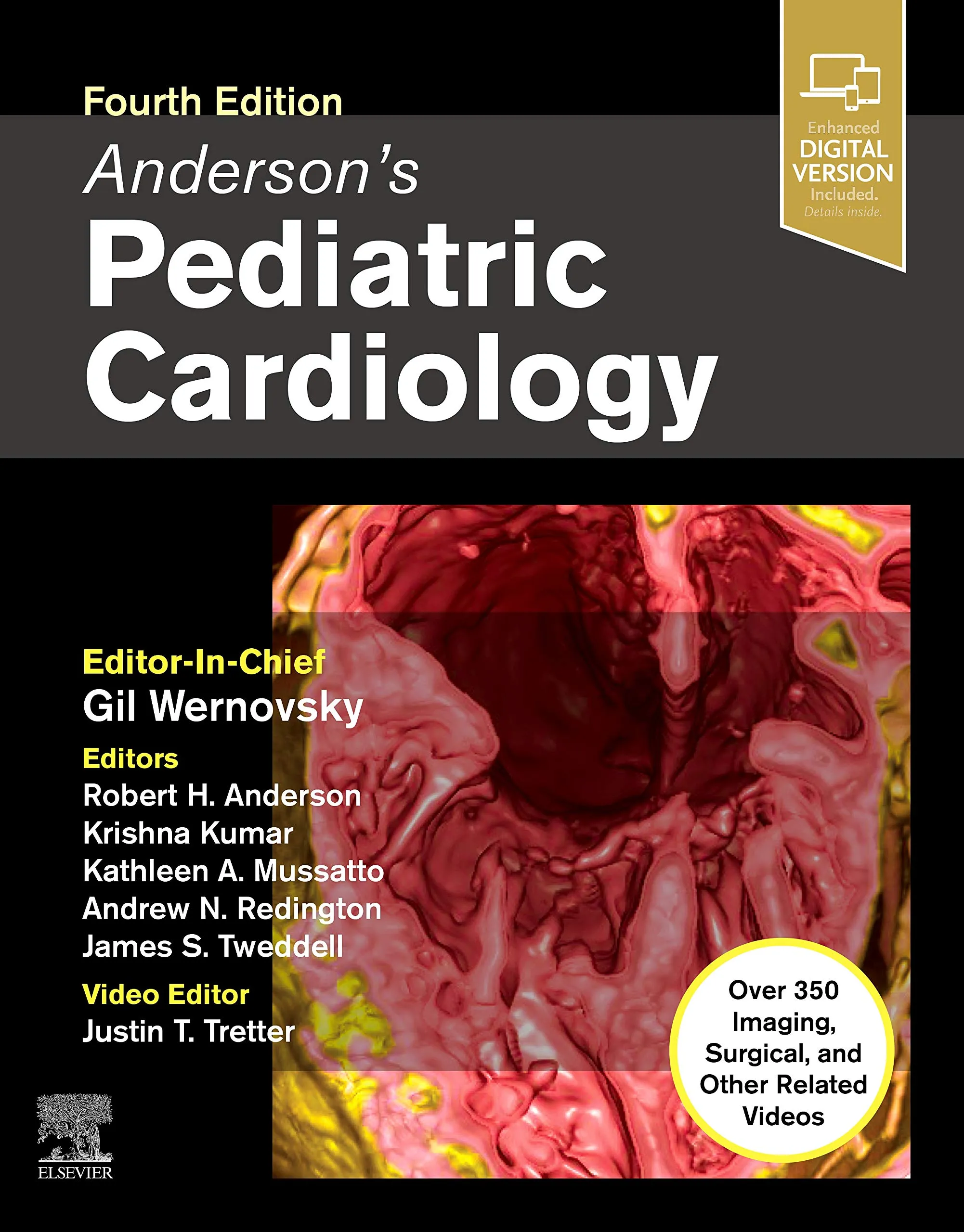 Anderson�s Pediatric Cardiology - 4th Edition