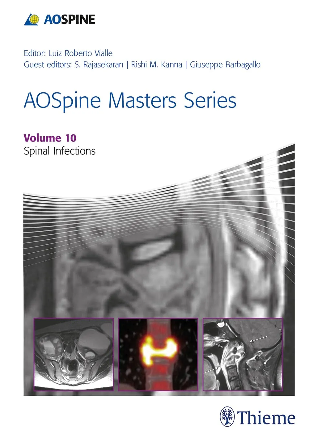 AOSpine Masters Series Volume 10: Spinal Infections 1st Edition
