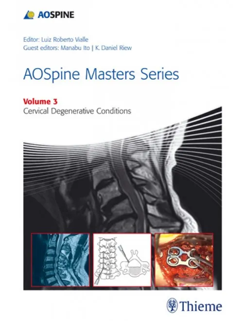 AOSpine Masters Series Volume 3: Cervical Degenerative Conditions - 1st Edition