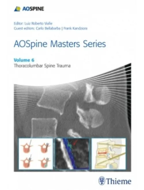 AOSpine Masters Series, Volume 6: Thoracolumbar Spine Trauma - 1st Edition