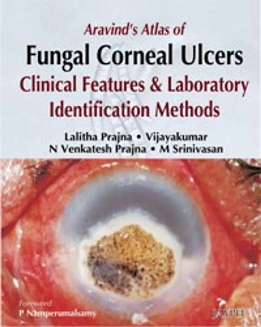 Aravind's Atlas of Fungal Corneal Ulcers | Clinical Features & Laboratory Identification Methods