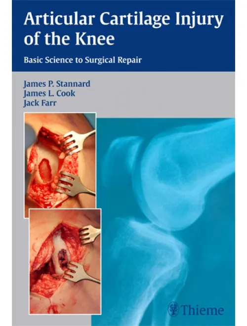 Articular Cartilage Injury of the Knee: Basic Science to Surgical Repair