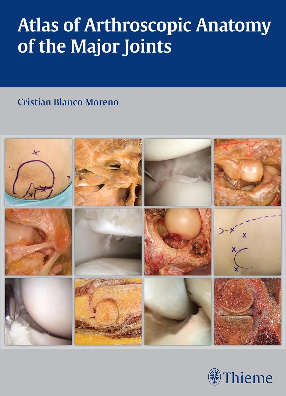 Atlas of Arthroscopic Anatomy of Major Joints 1st Edition