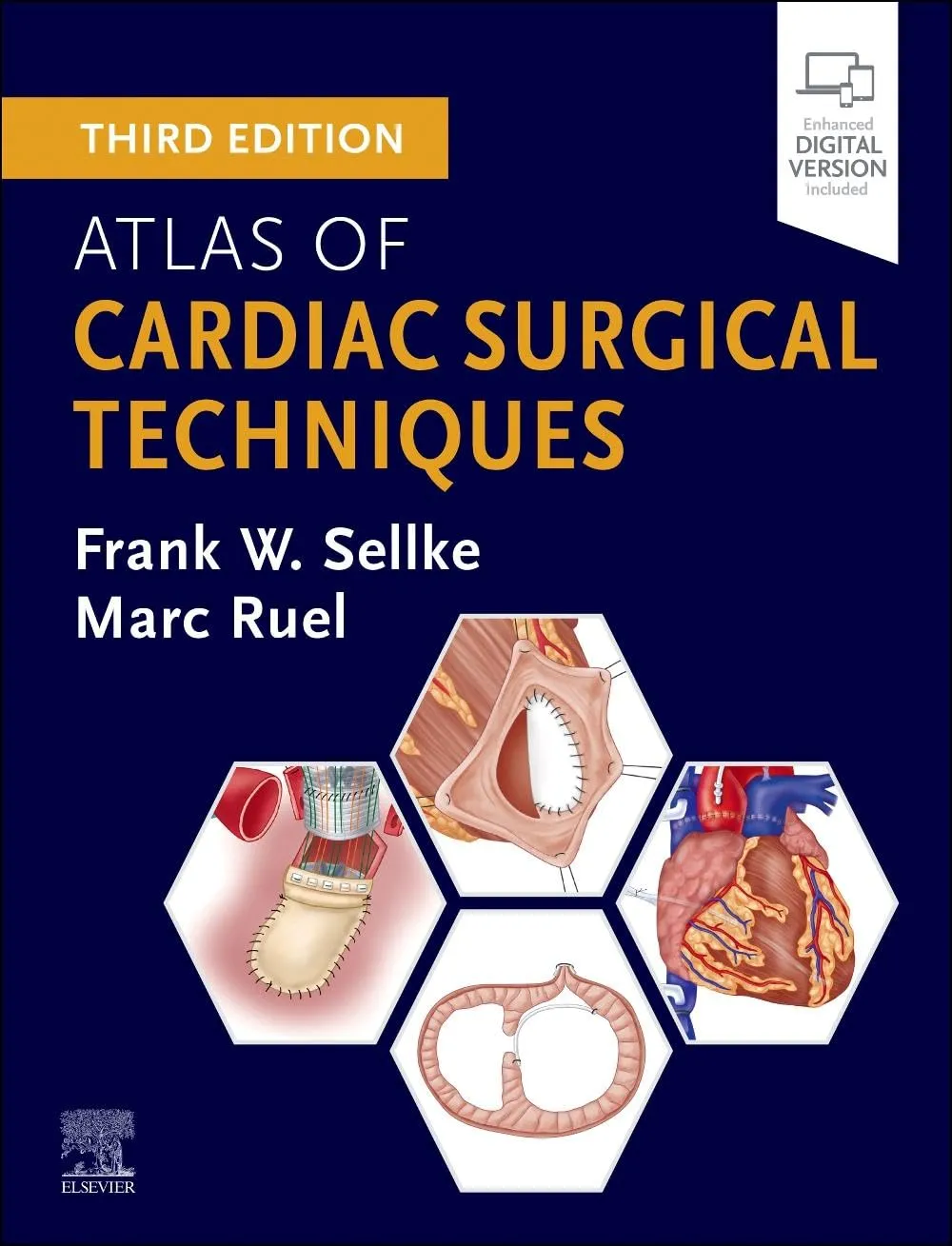 Image of Atlas of Cardiac Surgical Techniques - 3E