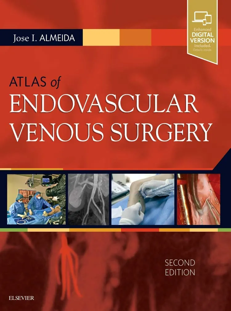 Atlas of Endovascular Venous Surgery: Expert Consult - Online and Print - 2E