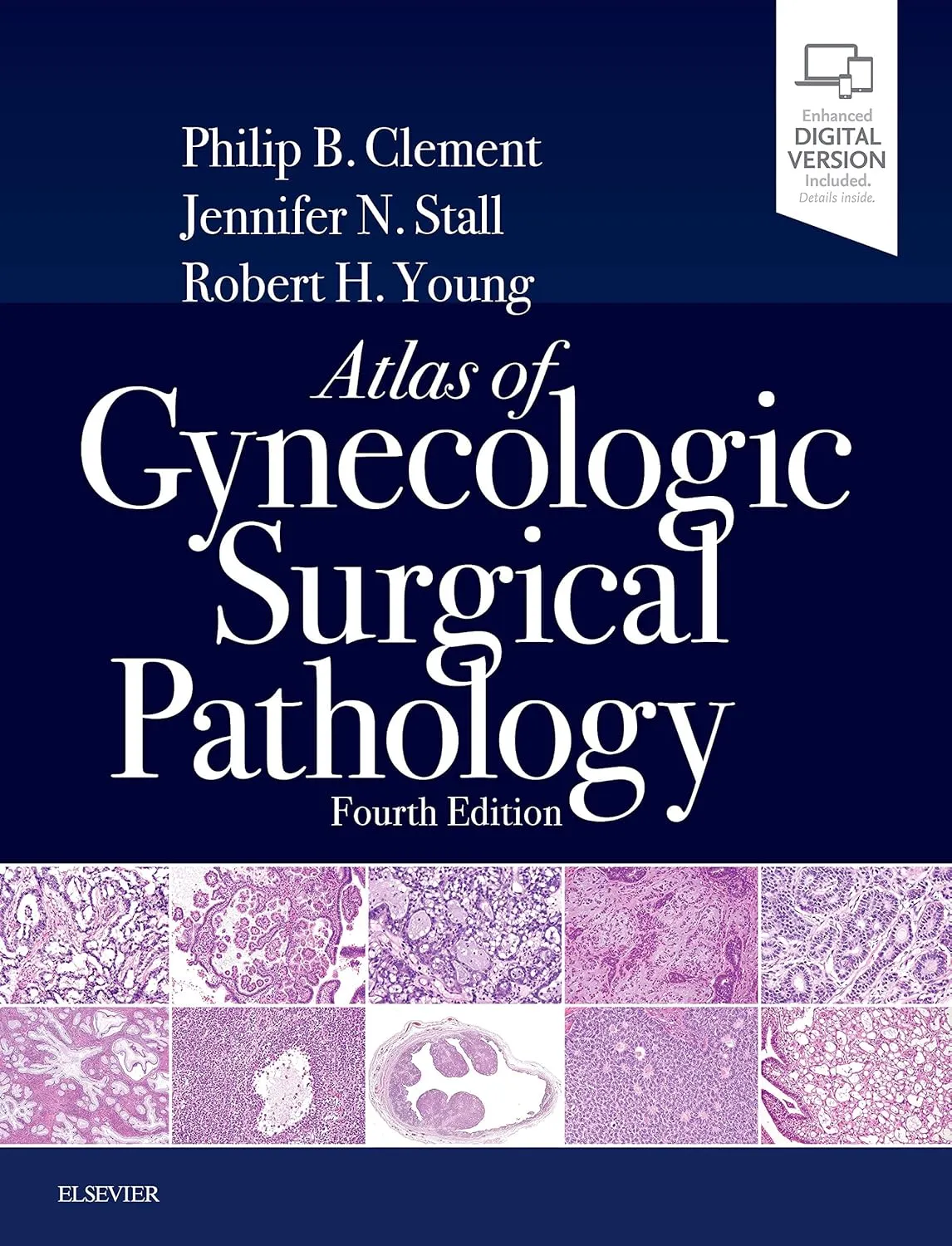 Atlas of Gynecologic Surgical Pathology -4E