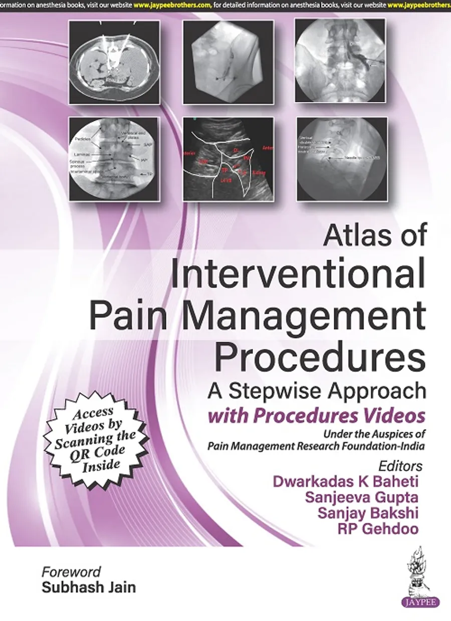 Atlas of Interventional Pain Management Procedures | A Stepwise Approach