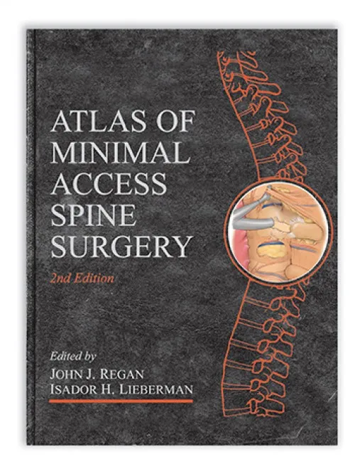 Atlas of Minimal Access Spine Surgery - 2nd Edition
