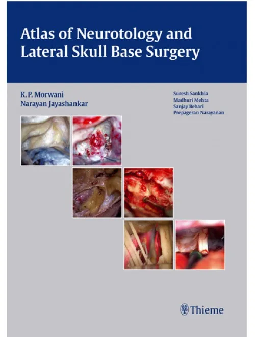 Atlas of Neurotology and Lateral Skull Base Surgery - 1st Edition