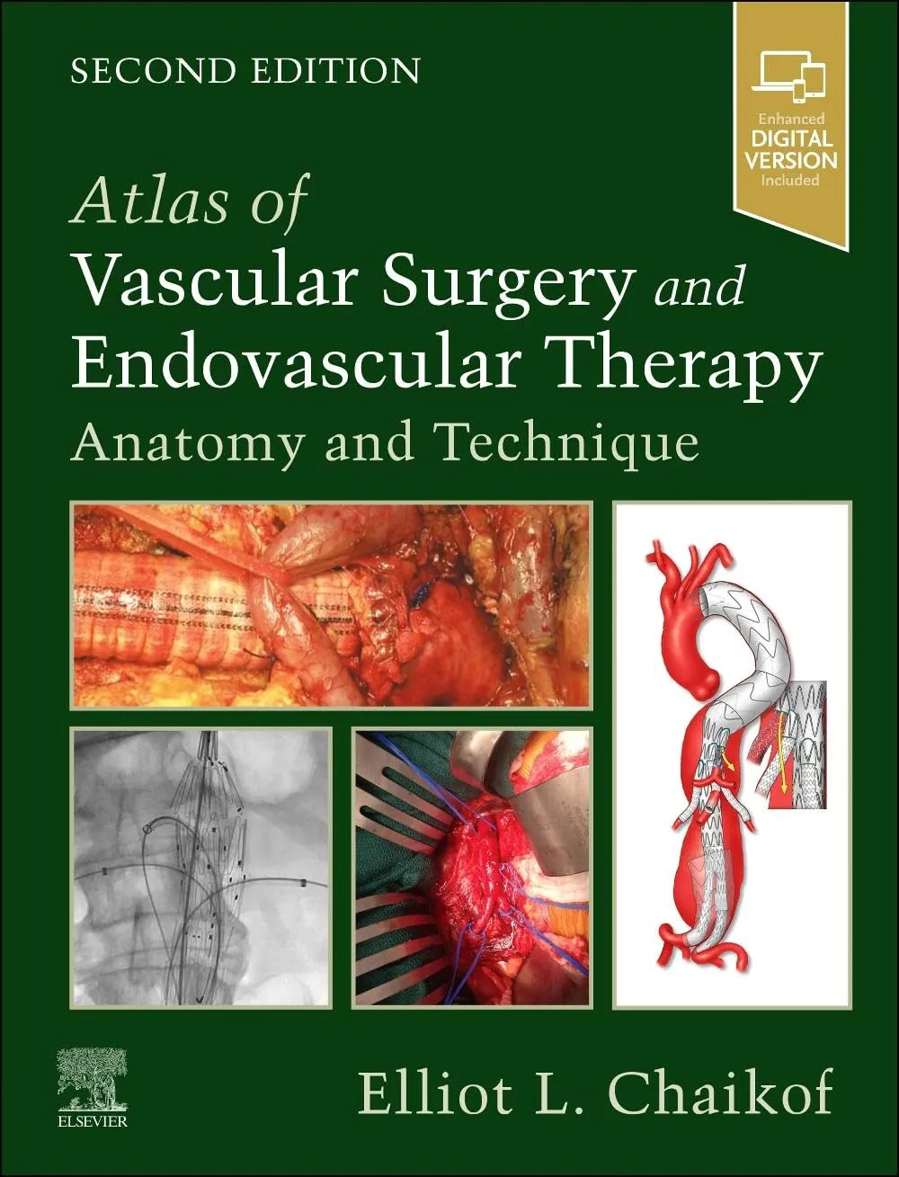 Atlas of Vascular Surgery and Endovascular Therapy: Anatomy and Technique - 2E