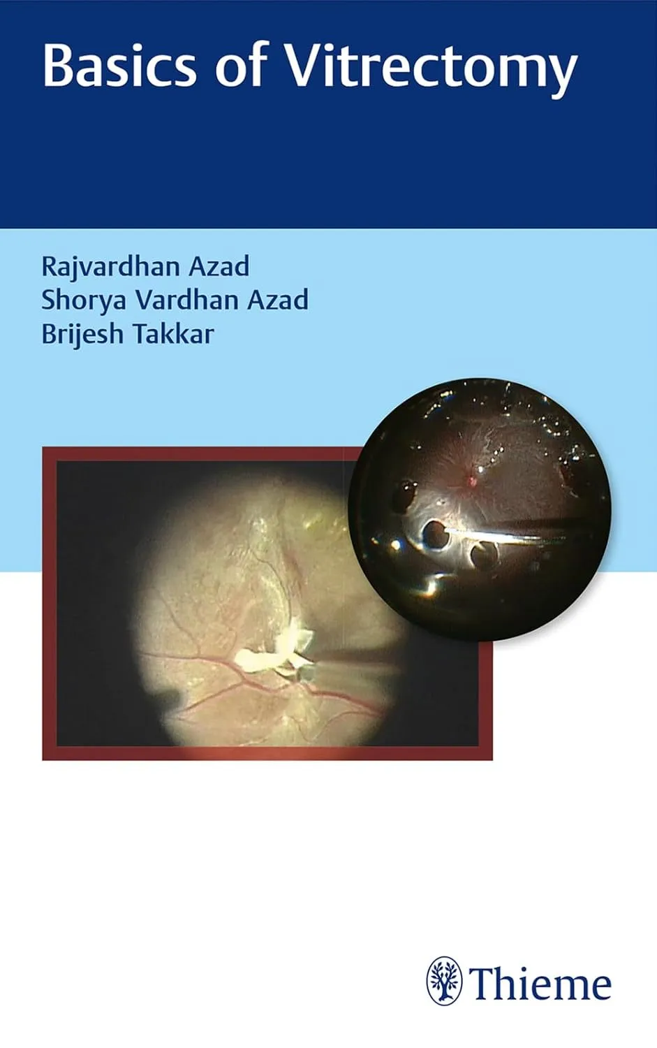 Basics of Vitrectomy 1st Edition