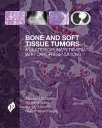 BONE AND SOFT TISSUE TUMORS:A MULTIDISCIPLINARY REVIEW WITH CASE PRESENTATIONS