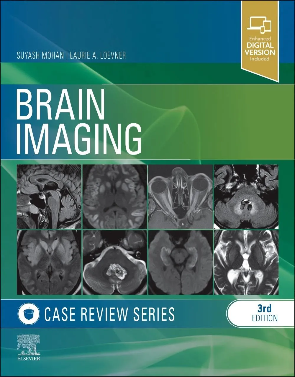 Brain Imaging: Case Review Series-3E