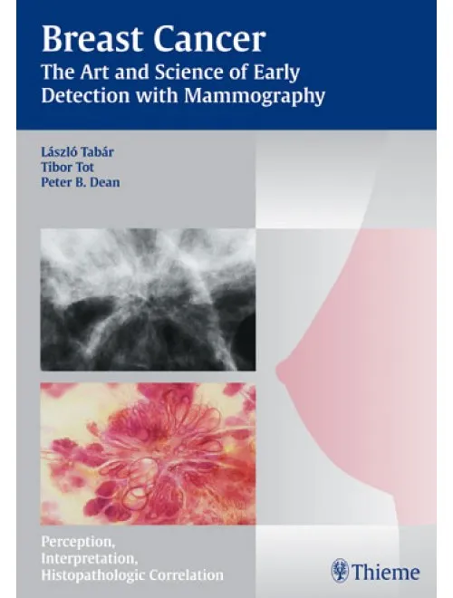 Breast Cancer - The Art and Science of Early Detec - 1st Edition
