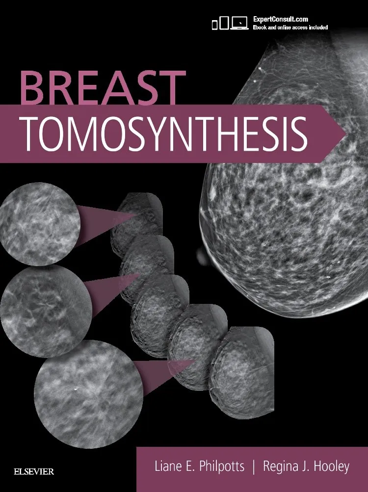 Breast Tomosynthesis -1E
