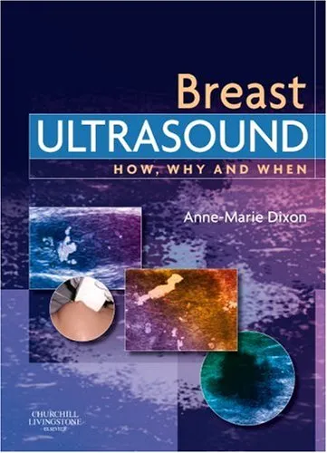 Breast Ultrasound How Why and When - 1st Edition