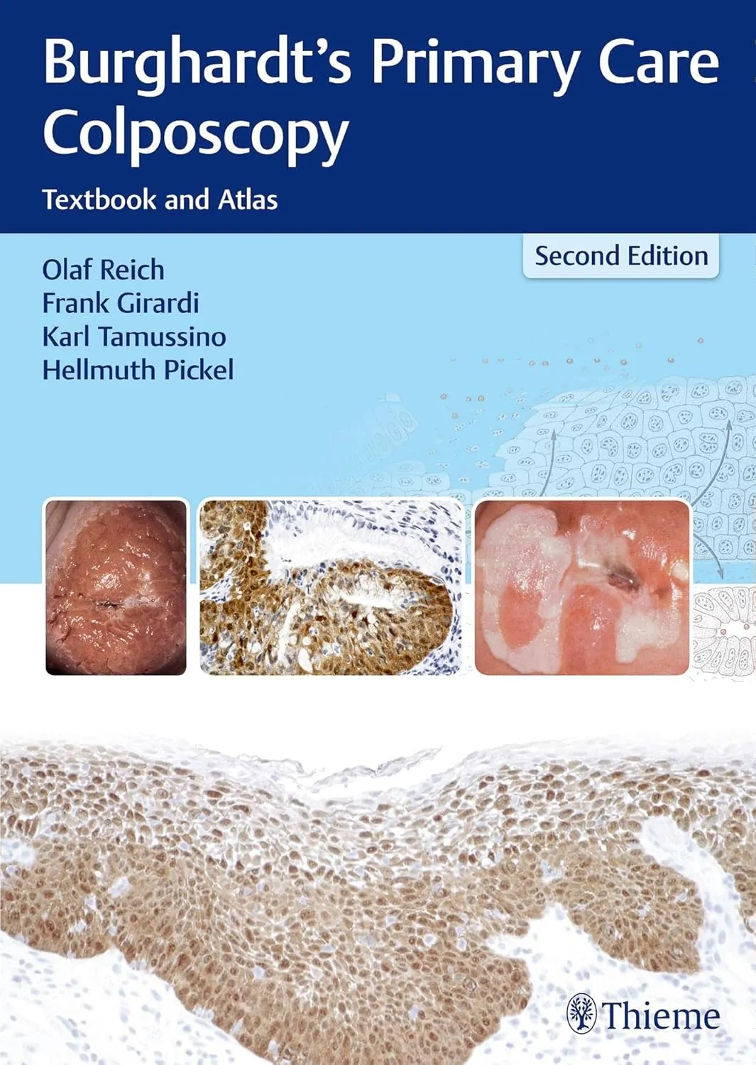 Burghardt's Primary Care Colposcopy 2nd Edition